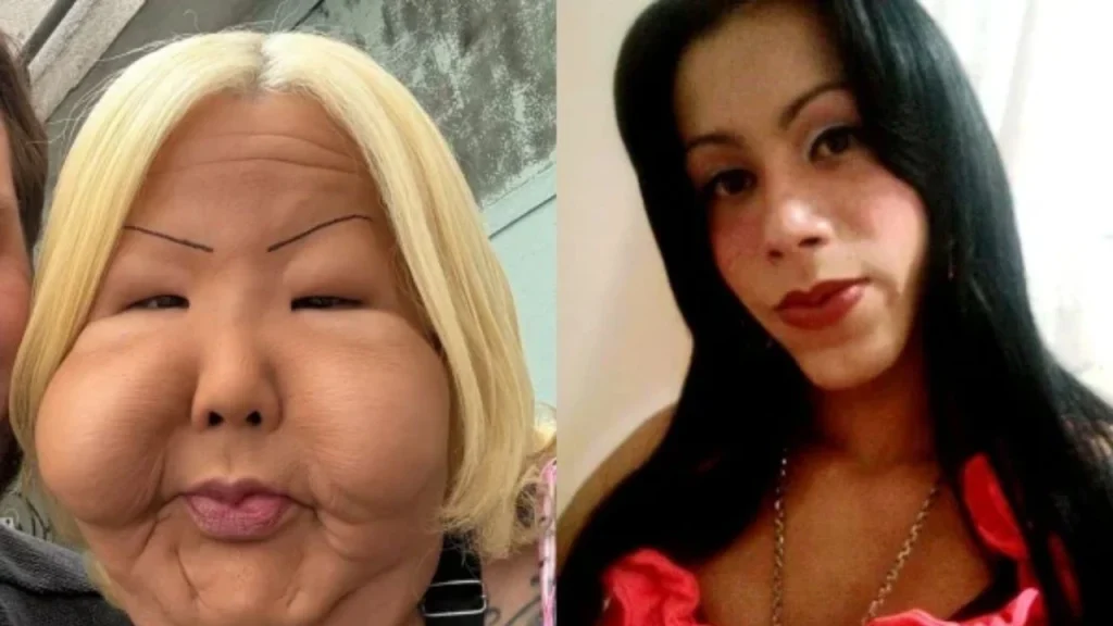 Influencer queda desfigurada tras someterse a un procedimiento clandestino