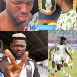 FORMER REMO STARS WINGER ADAMS OLAMILEKAN BRUTALLY ASSAULTED BY NIGERIAN POLICE IN ABUJA