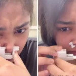 Joven intenta hacerse una perforación en la nariz sola y sale mal