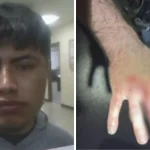 Migrante muerde a agente de ICE para evitar su detención en Louisiana