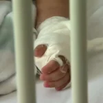 Niño pierde varios dedos de la mano tras explosión de pólvora en Colombia