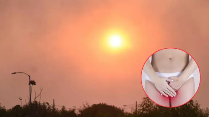 Ola de calor en Honduras provoca aumento de infecciones vaginales, advierten